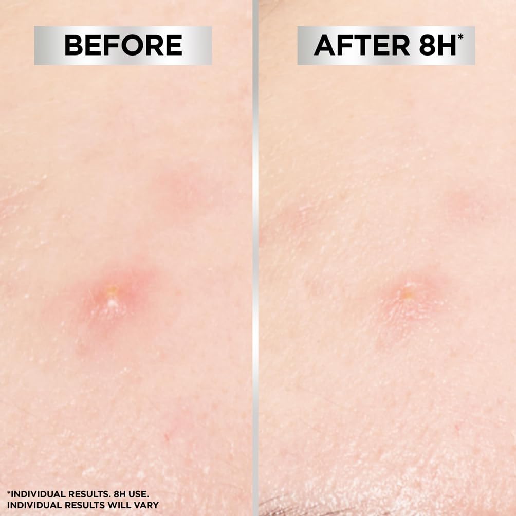 Garnier Invisible 8H Hydrocolloid Blemish Patches - 22 Patches
