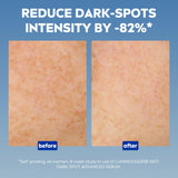 NIVEA Luminous 630 Anti Dark-Spot Advanced Face Serum 30ml with Hyaluronic Acid