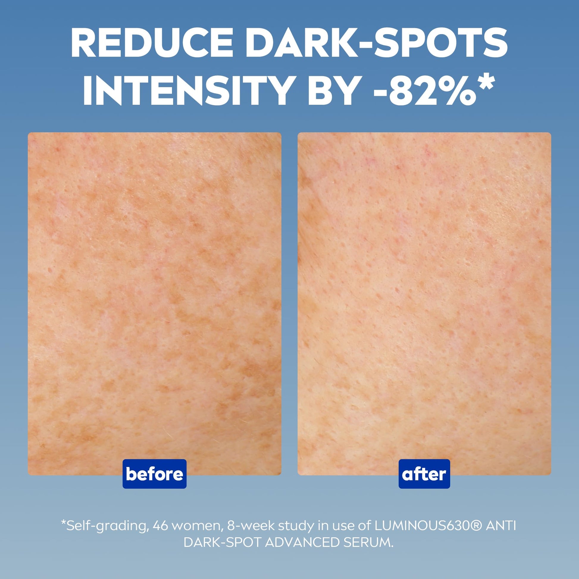 NIVEA Luminous 630 Anti Dark-Spot Advanced Face Serum 30ml with Hyaluronic Acid